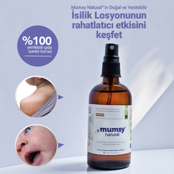 bebeklerde isilik bebeklerde islik nasıl geçer isilik kremi isiliğe ne sürülür isilik için