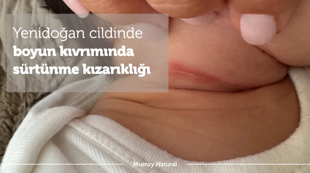 Bebekte boyun kıvrımında sürtünme kızarıklığı örneği