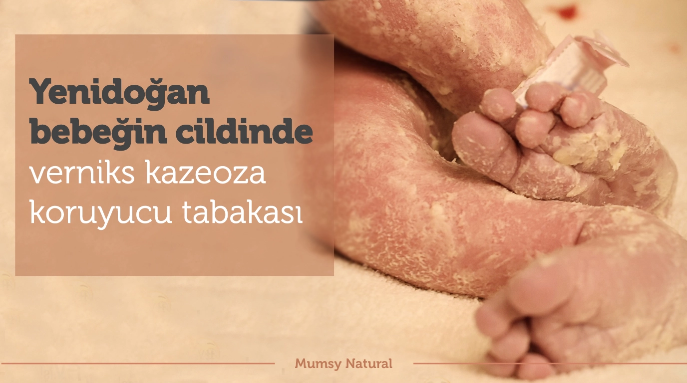 Yenidoğan bebeğin cildinde verniks kazeoza koruyucu tabakası