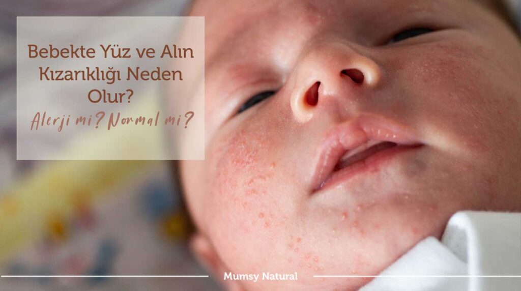 Bebekte yüz ve alın bölgesinde kızarıklık görünümü